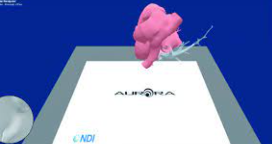Software Framework for VR-Enabled Transcatheter Valve Implantation in Unity