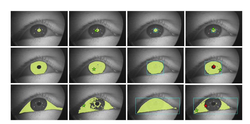 Zero-Shot Segmentation of Eye Features Using the Segment Anything Model (SAM)